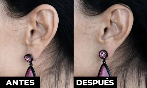 LEVANTADOR DE ARETES + ESTUCHE
